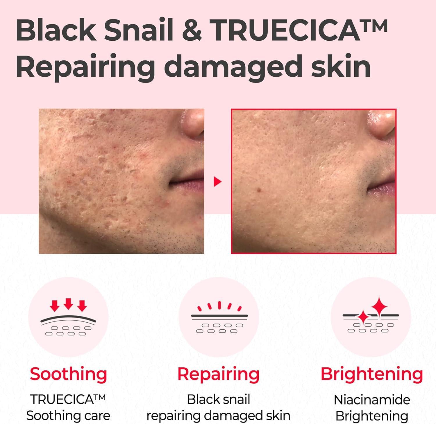 Snail Truecica Miracle Repair Toner 150ml | SOME BY MI