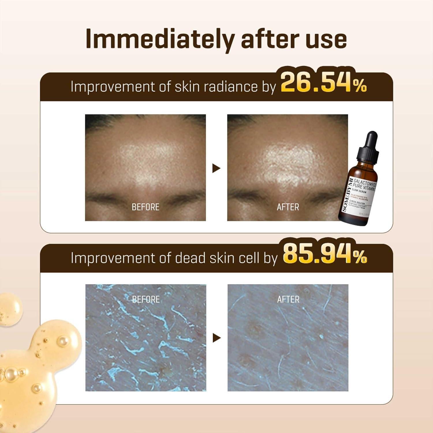 Galactomyces Pure Vitamin C Glow Serum 30ml | SOME BY MI