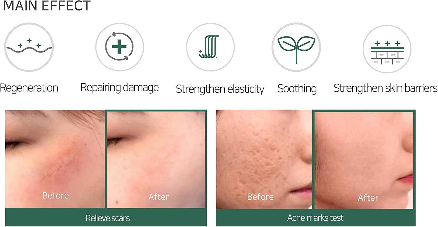 AHA-BHA-PHA 30 Days Miracle Cream 60g | SOME BY MI