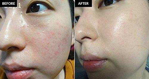 Midnight Blue Soothing Treatment Cream (30ml) | Klairs