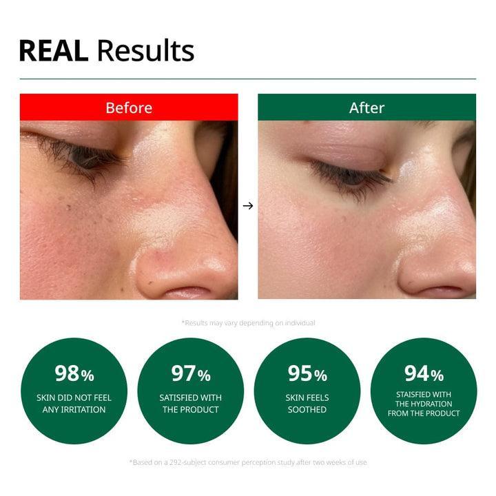 Revitalising Red Blemish Soothing Cream (70ml) | Dr.G