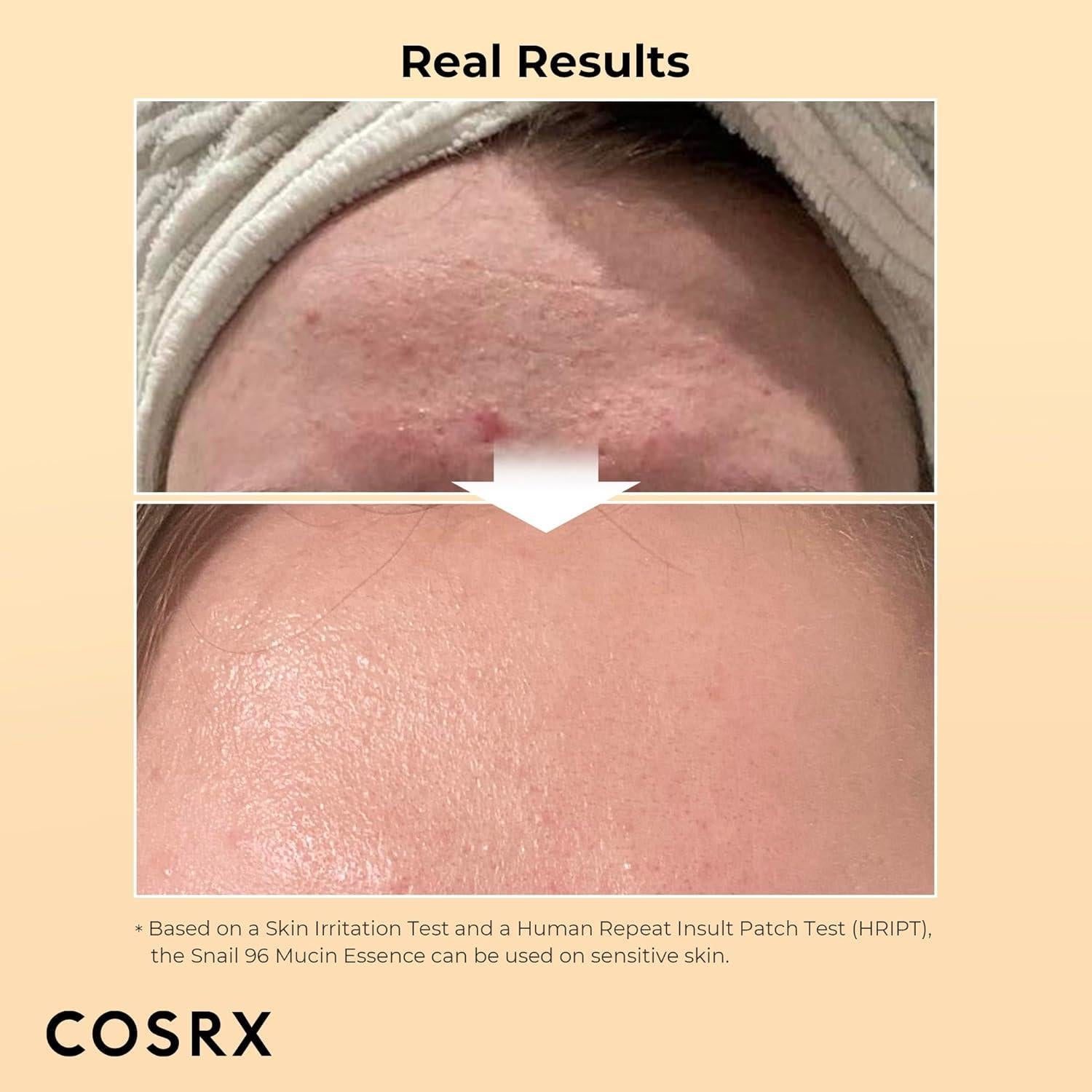 Radiance di lusso: Advanced Snail 96 Mucin Power Essence (100 ml) | COSRX