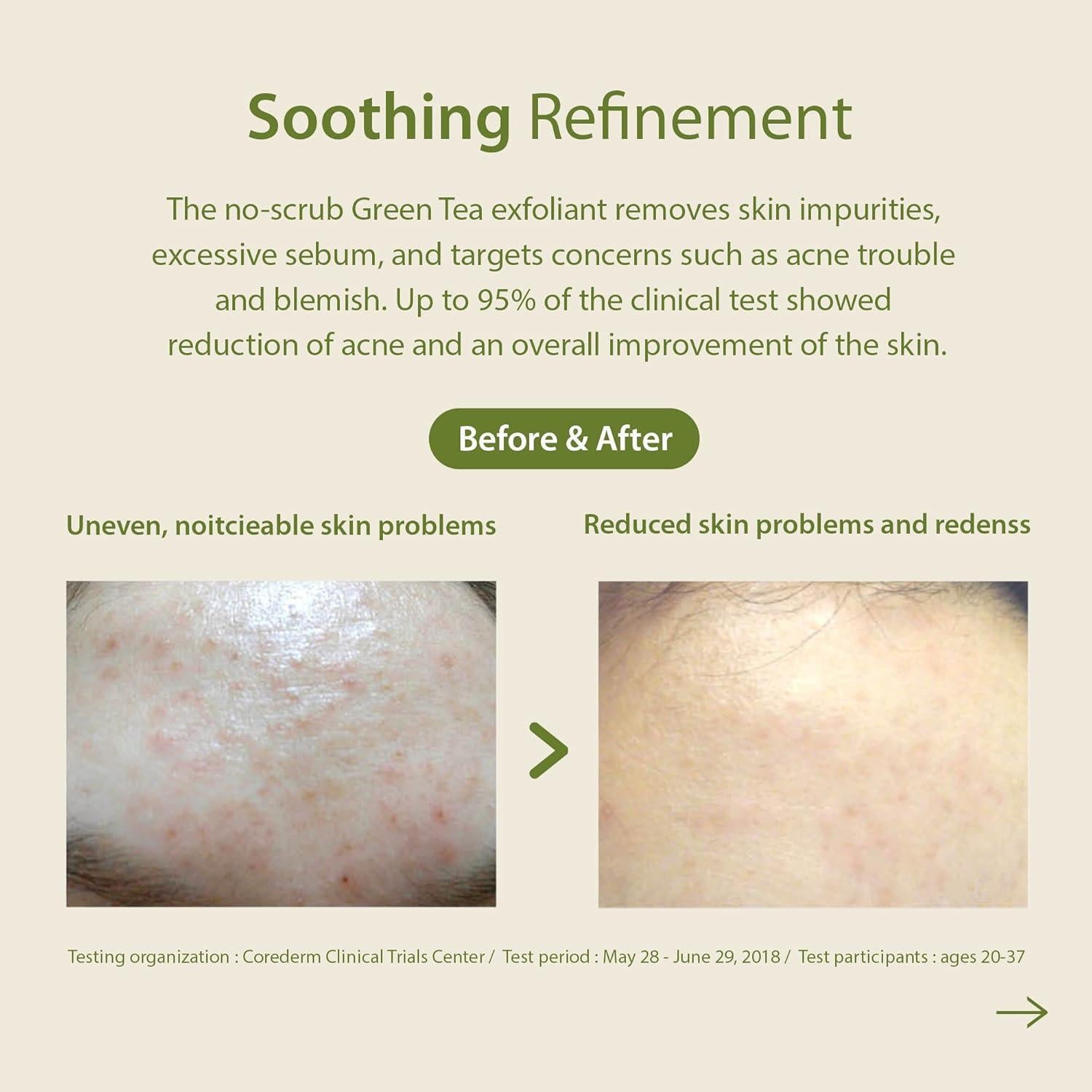 Patting Splash Mask Soothing & Healing Green Tea 150ml | Blithe