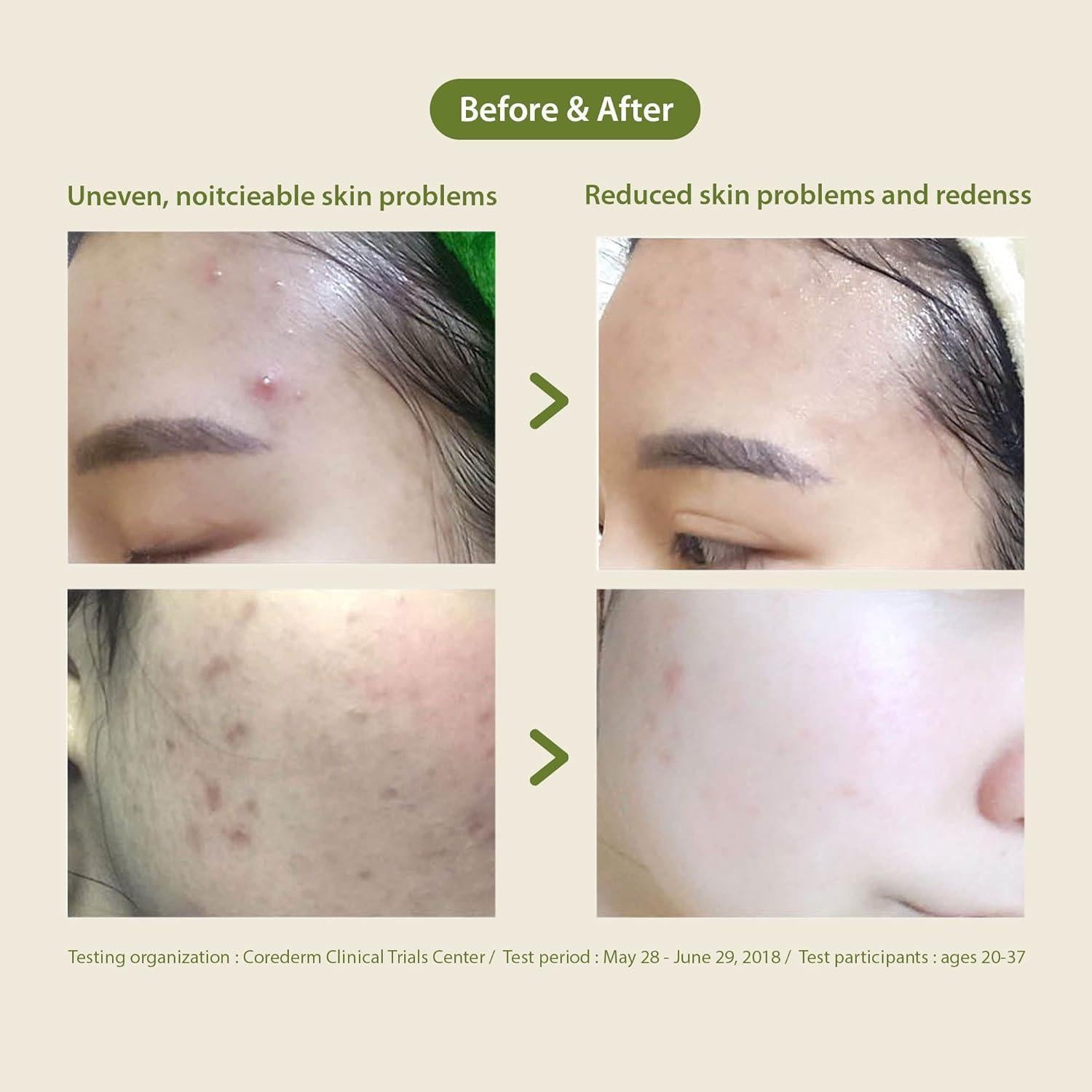 Patting Splash Mask Soothing & Healing Green Tea 150ml | Blithe