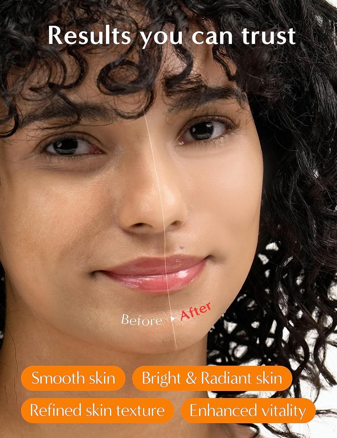 Revitalising Yeast Extract Elixir for Skin Vitality (30ml) | It'S SKIN