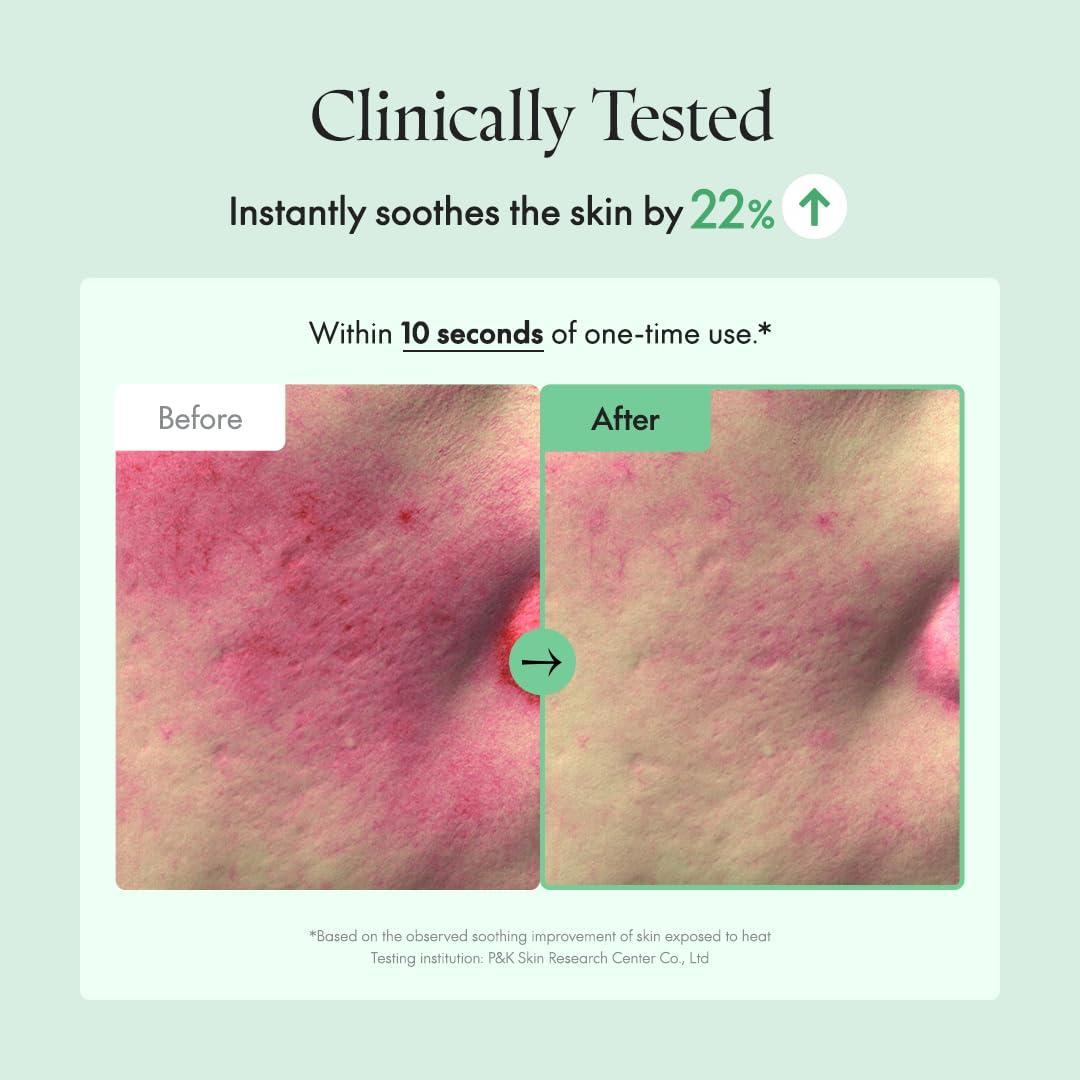 Wonder Releaf Centella Serum Unscented 60ml | PURITO