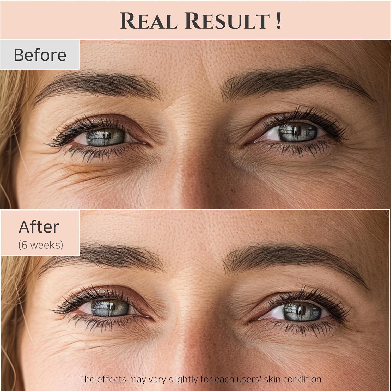Revitalising Ginseng & Retinal Eye Elixir (30ml) | Beauty of Joseon