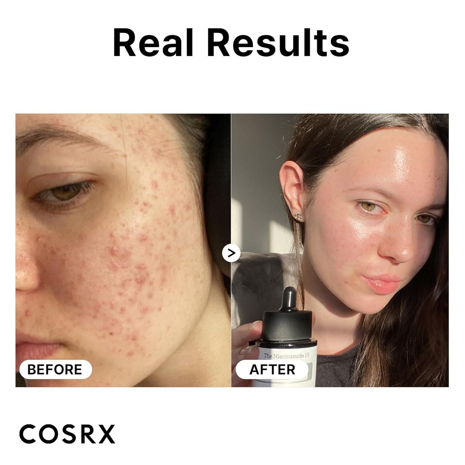 Siero Radiant Glow Niacinamide 15 (20 ml) | COSRX