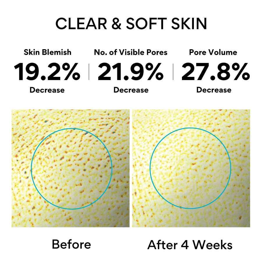 Revitalising Pure Retinol Cica Repair Ampoule (30ml) | innisfree