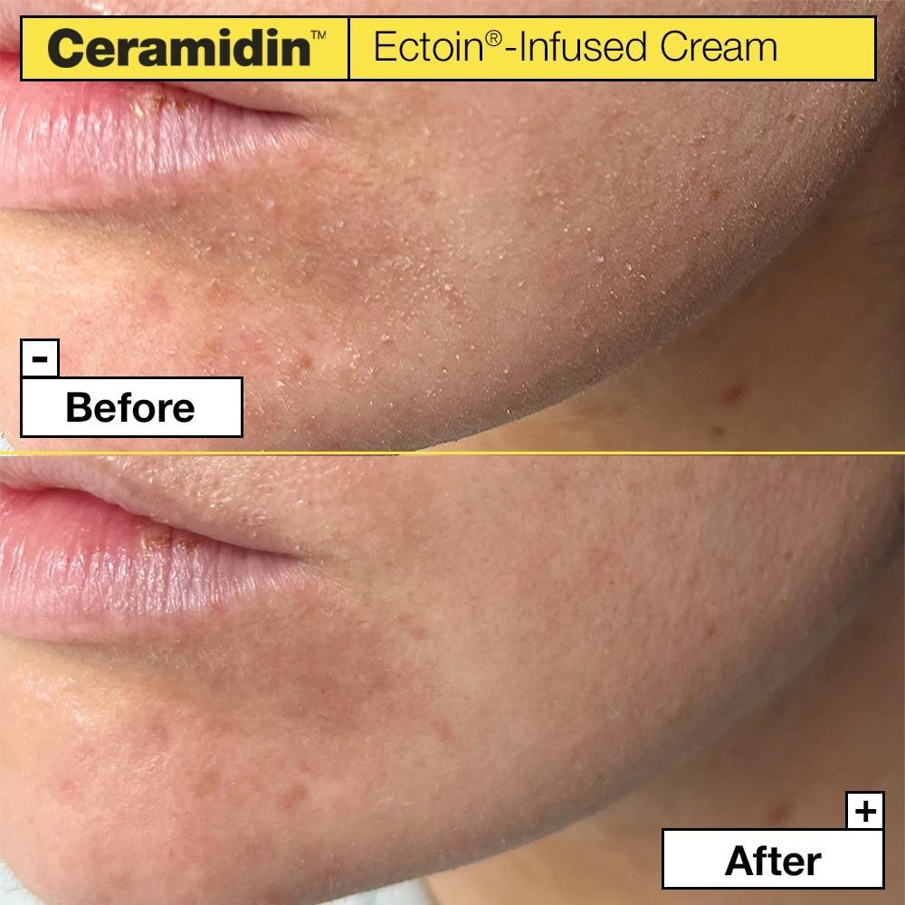 Ectoin-Enriched Ceramidin Luxe Barrier Cream (50ml) | Dr.Jart+