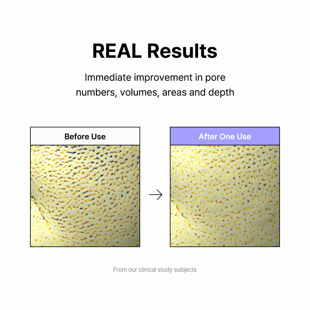 Vitamin A-mazing Bakuchiol Night Cream 30g | ByWishtrend