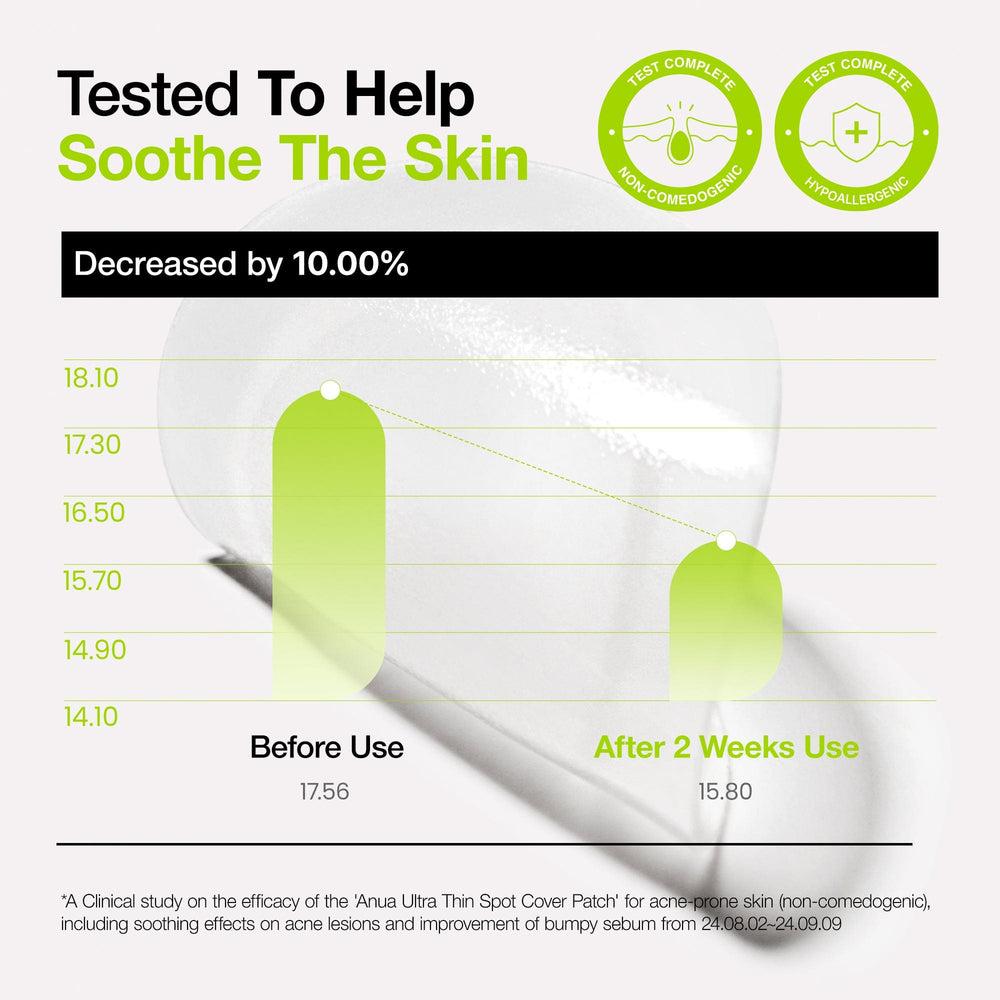 Ultra Thin Spot Cover Patch 75ea | Anua