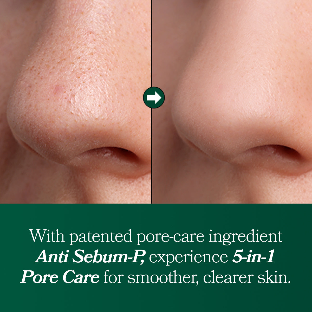 Fresh Lime Glow & Pore Refining Serum 50ml | Omitted