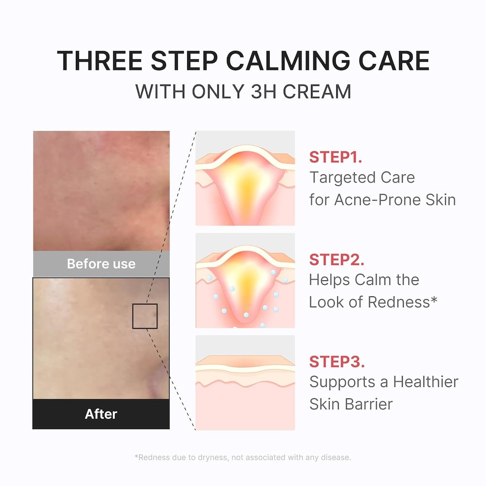 Hypochlorous 3H Relief Cream 50ml | MEDICUBE