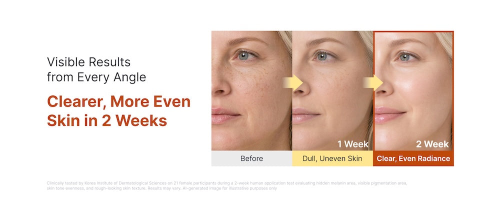 Kojic Acid Niacinamide Brightening Capsule Cream 55g | Sungboon Editor