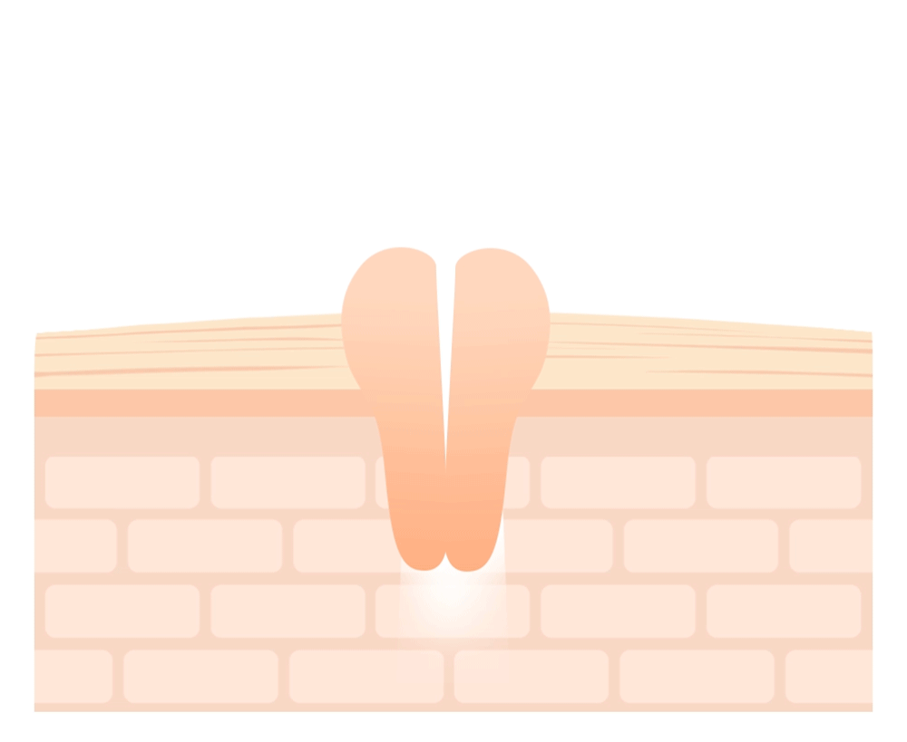 Crossbarrier Mask 30 sheets | NEEDLY