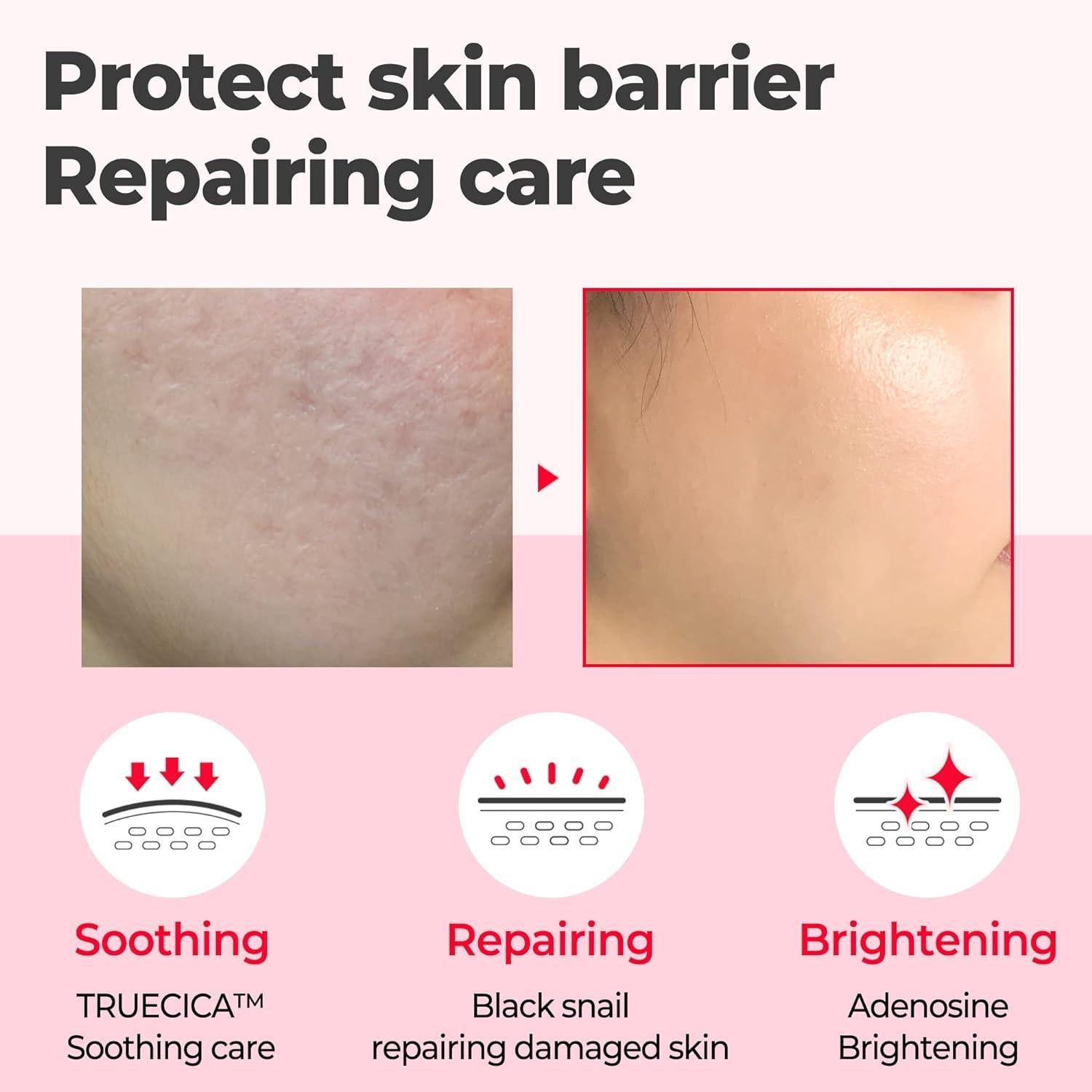 Snail Truecica Miracle Repair Serum 50ml | SOME BY MI