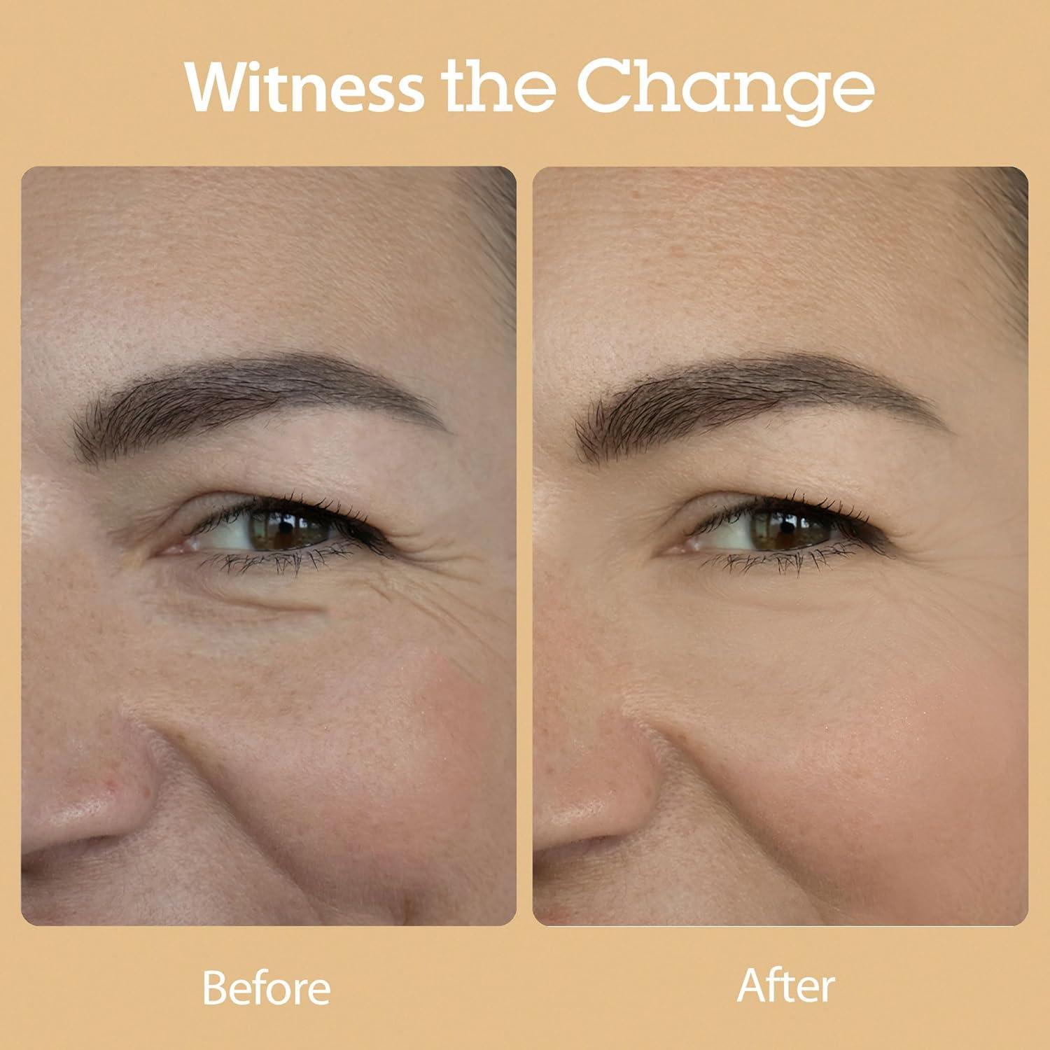 Vital Treatment 8 Nourishing Beans 150ml | Blithe