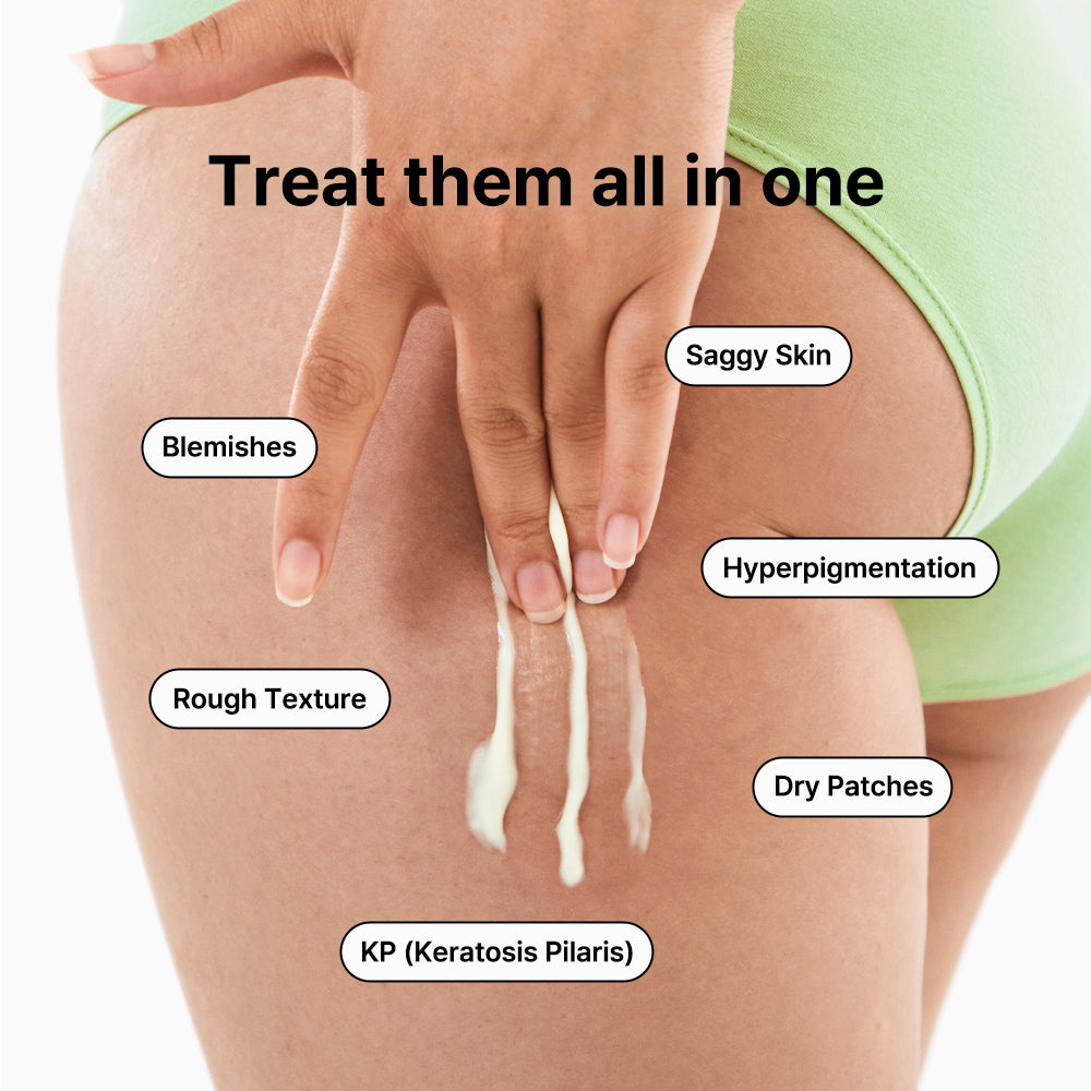 Vitamin A mazing Bakuchiol Body Lotion 150g | ByWishtrend