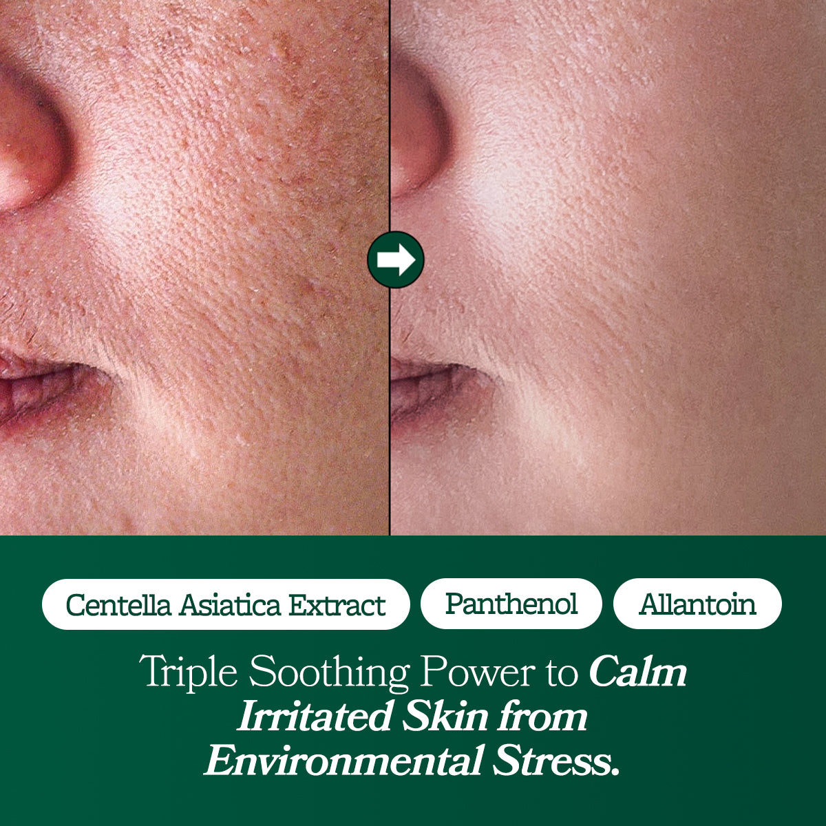 Fresh Lime Glow & Super Hydrating Moisturizer 80ml | Omitted