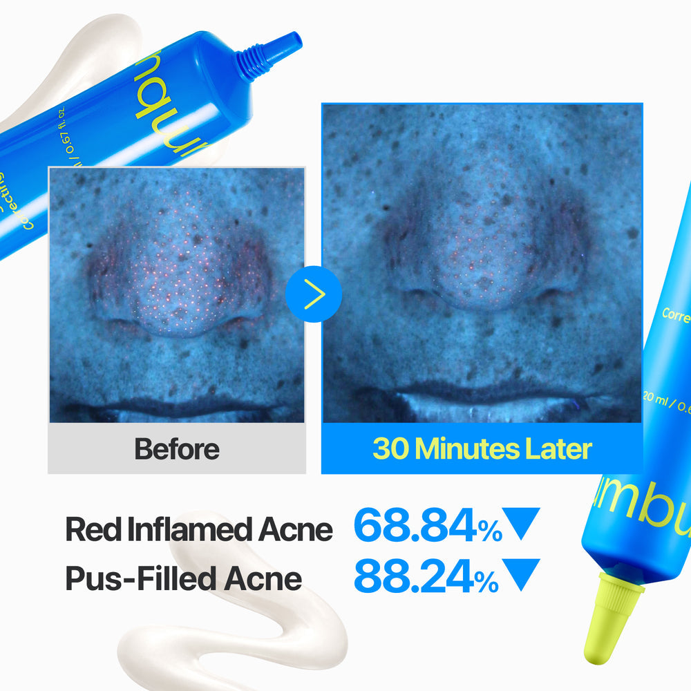 Numbuzin Zero Blemish Spot Correcting Cream for Radiant Skin