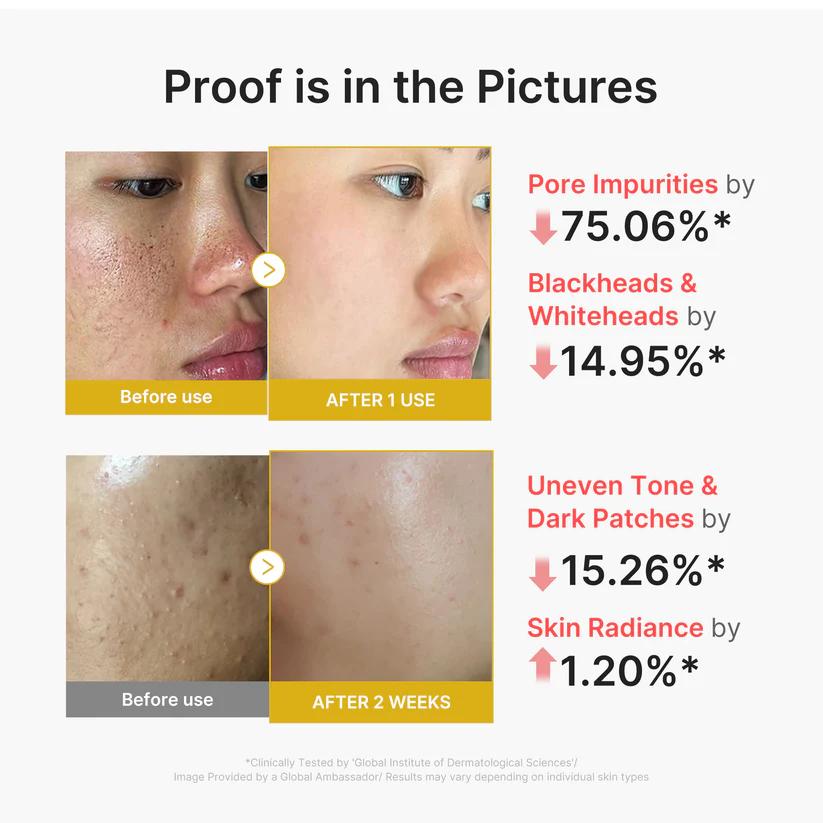 Kojic Acid Turmeric Peel Shot 80ml | MEDICUBE